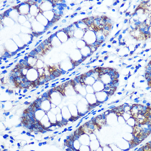 Epigenetics and Nuclear Signaling Antibodies 1 Anti-RRM1 Antibody CAB1152