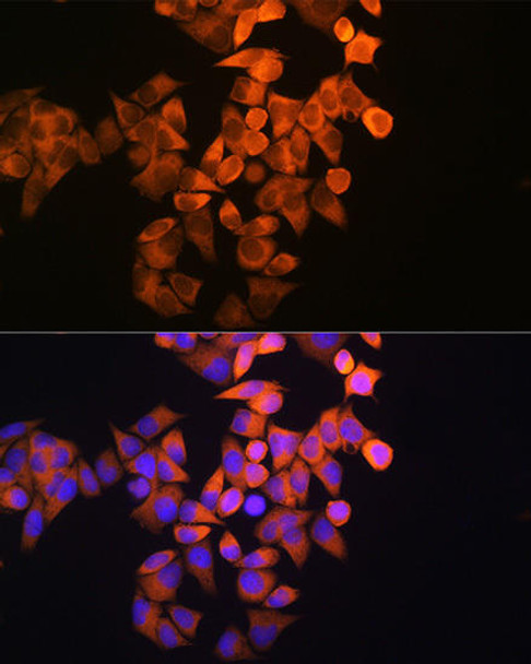 Epigenetics and Nuclear Signaling Antibodies 1 Anti-RRM1 Antibody CAB1152