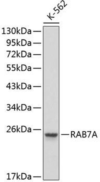 Autophagy Antibodies Anti-RAB7A Antibody CAB1154