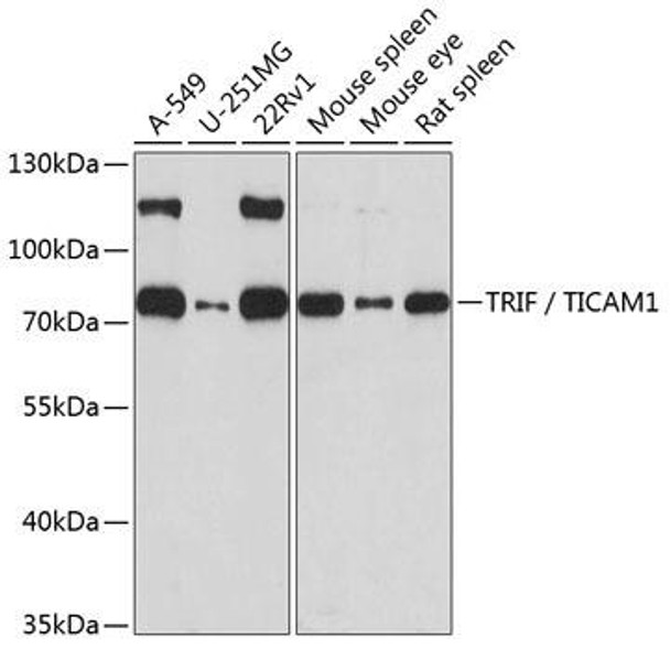 Immunology Antibodies 1 Anti-TRIF / TICAM1 Antibody CAB1155