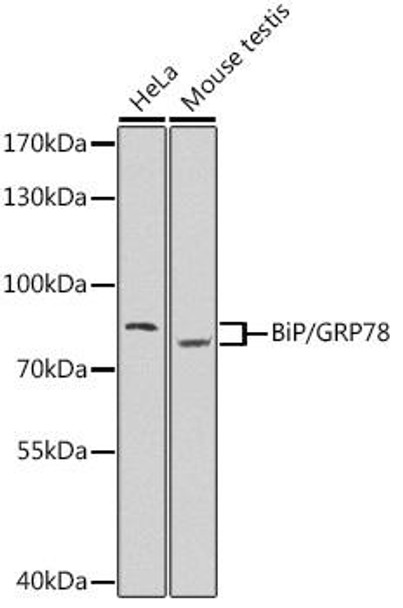 Cell Biology Antibodies 2 Anti-BiP/GRP78 Antibody CAB11568