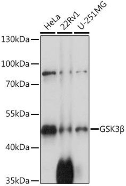 Cell Biology Antibodies 2 Anti-GSK3Beta Antibody CAB11578