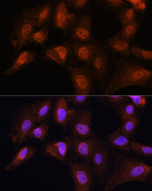 Epigenetics and Nuclear Signaling Antibodies 1 Anti-BCL3 Antibody CAB11582