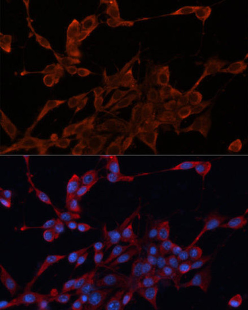 Cell Biology Antibodies 2 Anti-DNAJA1 Antibody CAB11602