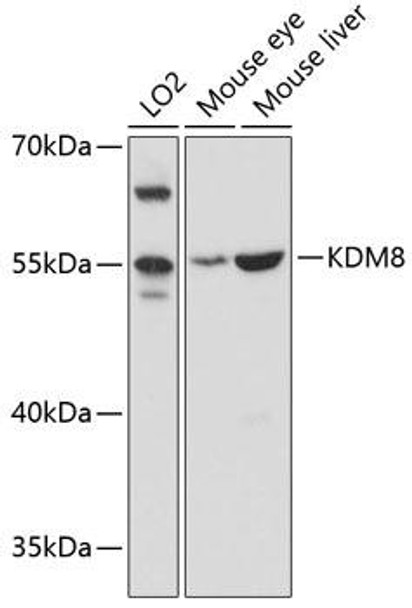 Cell Biology Antibodies 2 Anti-KDM8 Antibody CAB11606