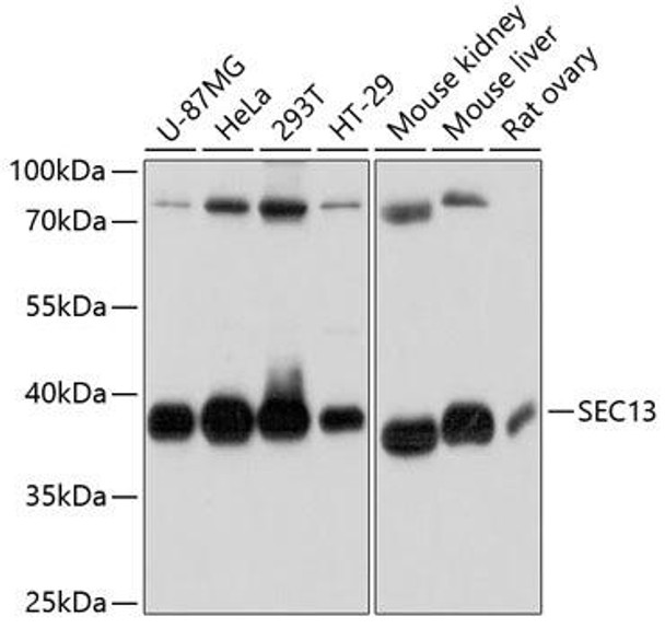 Cell Biology Antibodies 2 Anti-SEC13 Antibody CAB11613