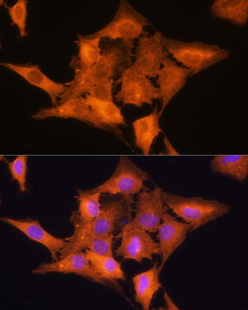 Metabolism Antibodies 1 Anti-ALDOC Antibody CAB11618