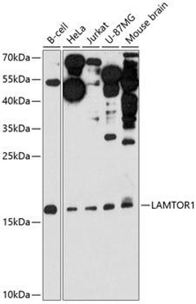 Cell Biology Antibodies 2 Anti-LAMTOR1 Antibody CAB11619
