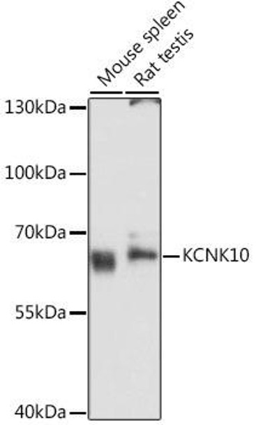 Signal Transduction Antibodies 1 Anti-KCNK10 Antibody CAB11681
