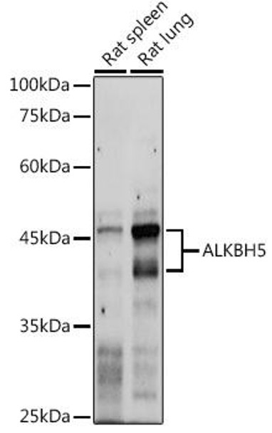 Developmental Biology Anti-ALKBH5 Antibody CAB11684