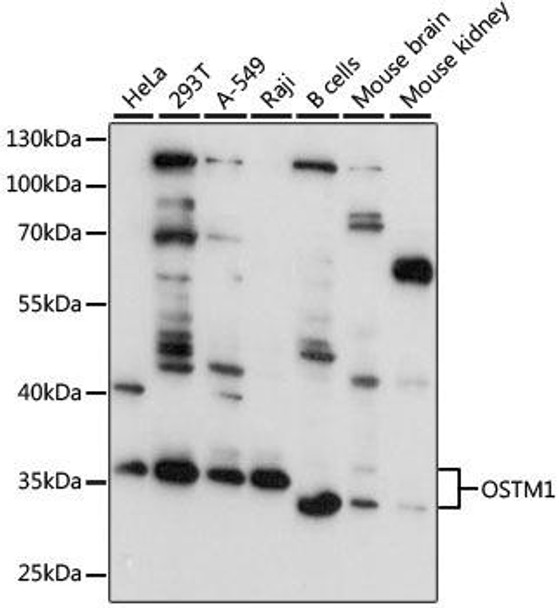 Cell Biology Antibodies 2 Anti-OSTM1 Antibody CAB11685