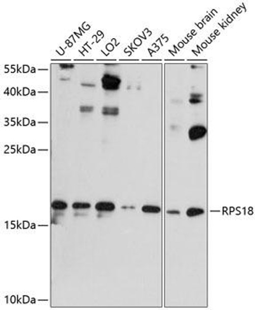 Cell Biology Antibodies 2 Anti-RPS18 Antibody CAB11687