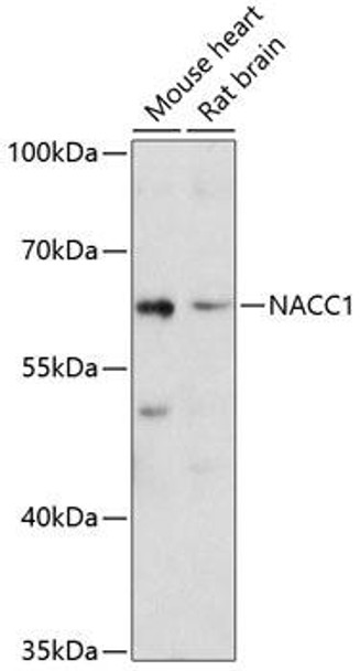 Epigenetics and Nuclear Signaling Antibodies 1 Anti-NACC1 Antibody CAB11709