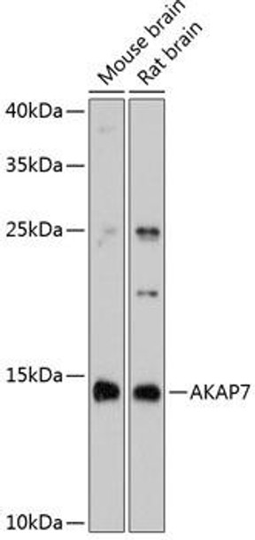 Cell Biology Antibodies 2 Anti-AKAP7 Antibody CAB11728