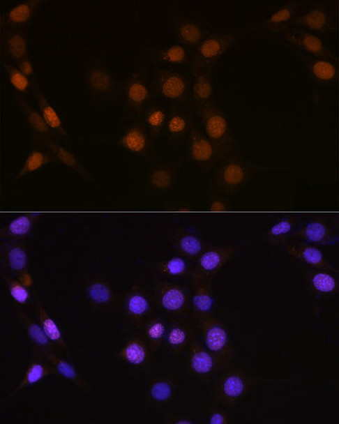Cell Cycle Antibodies 1 Anti-CDC25A Antibody CAB1173