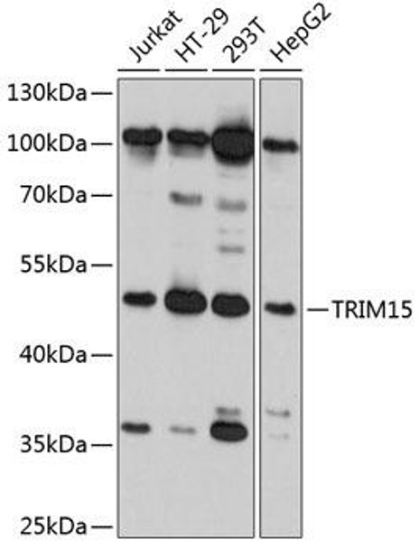 Cell Biology Antibodies 2 Anti-TRIM15 Antibody CAB11730