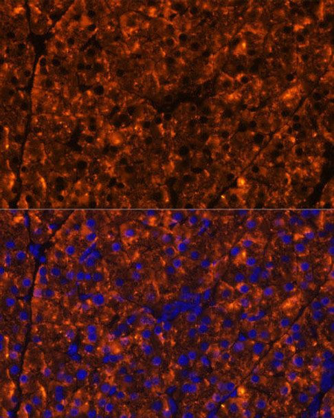 Cell Biology Antibodies 2 Anti-SERPINI2 Antibody CAB11732