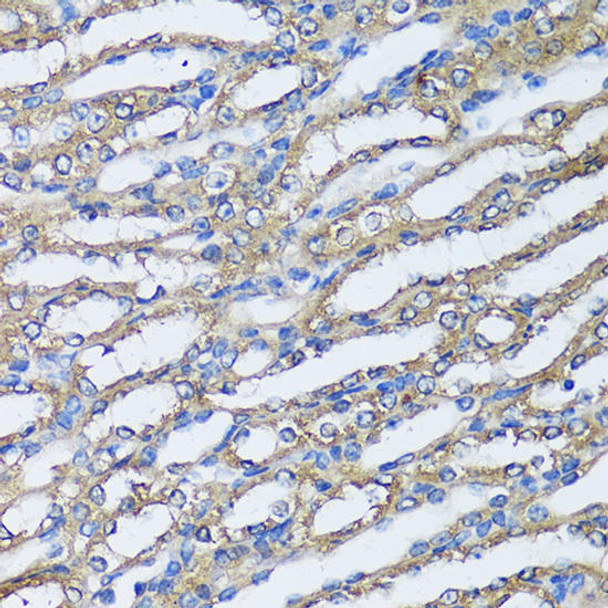 Cell Biology Antibodies 2 Anti-NQO2 Antibody CAB11746