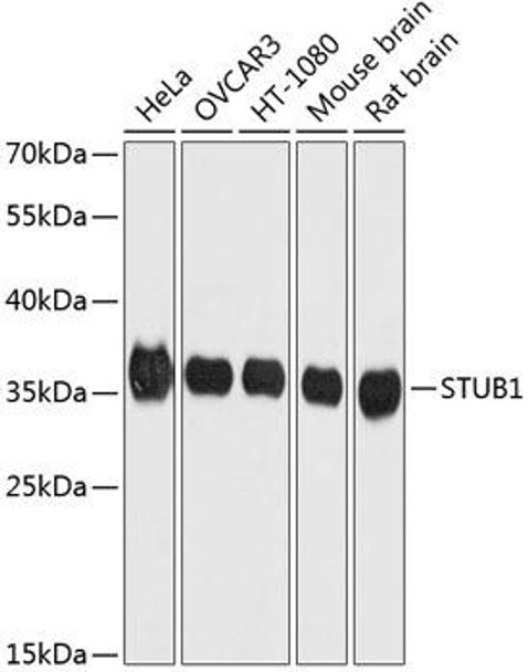 Epigenetics and Nuclear Signaling Antibodies 1 Anti-STUB1 Antibody CAB11751