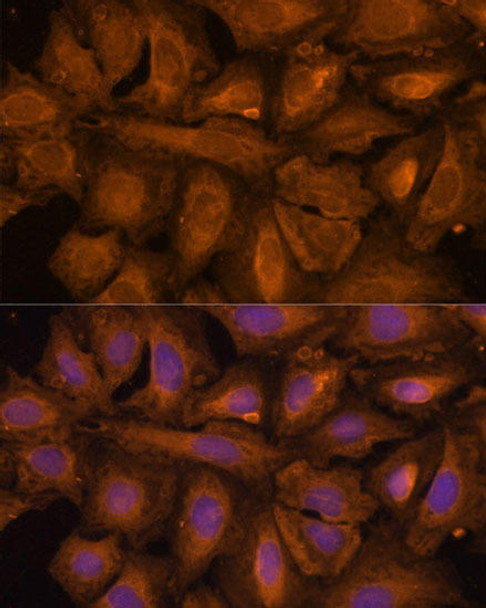 Epigenetics and Nuclear Signaling Antibodies 1 Anti-STUB1 Antibody CAB11751