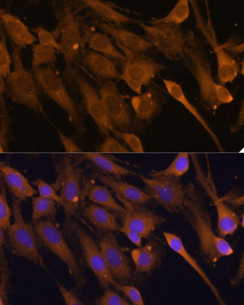 Epigenetics and Nuclear Signaling Antibodies 1 Anti-STUB1 Antibody CAB11751