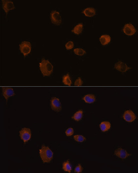 Cell Biology Antibodies 2 Anti-MMP13 Antibody CAB11755