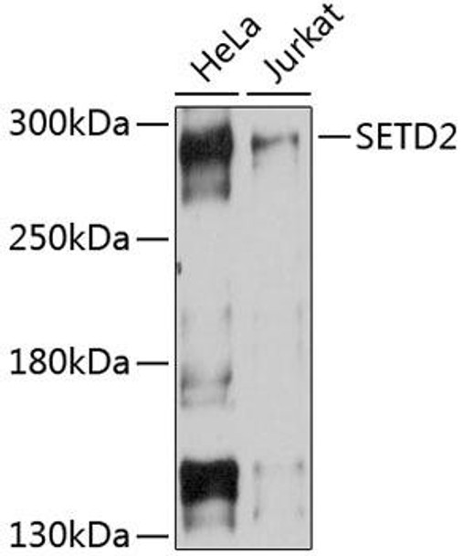 ChIP Antibodies Anti-SETD2 Antibody CAB11757