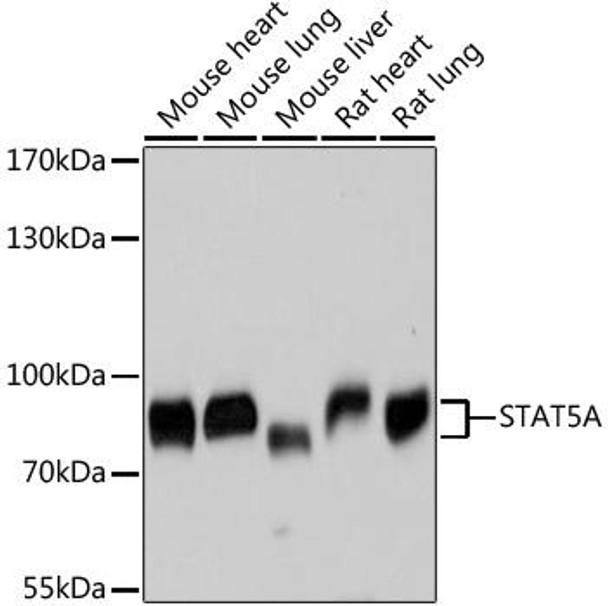 Cell Biology Antibodies 2 Anti-STAT5A Antibody CAB11779