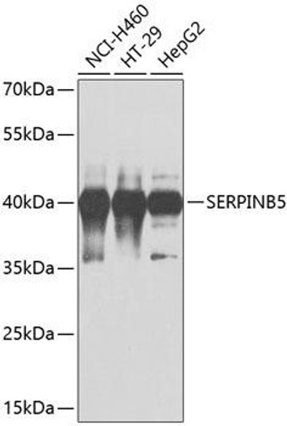 Cell Biology Antibodies 2 Anti-SERPINB5 Antibody CAB1179