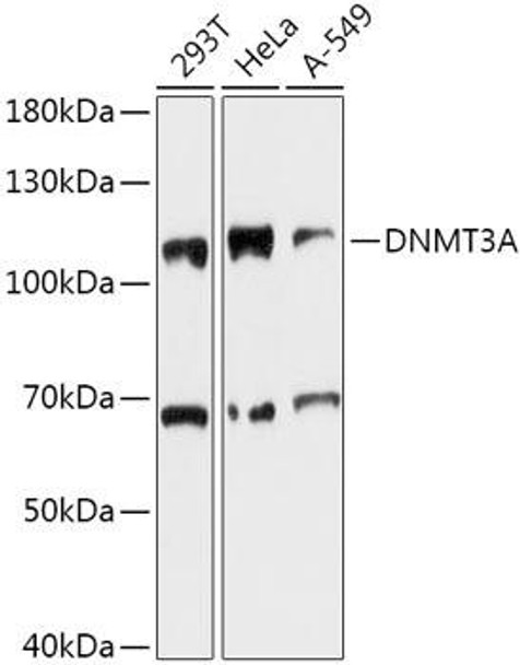 Cell Biology Antibodies 2 Anti-DNMT3A Antibody CAB11791