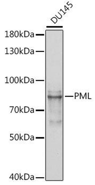 KO Validated Antibodies 1 Anti-PML Antibody CAB1184KO Validated