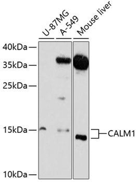 Cell Biology Antibodies 2 Anti-CALM1 Antibody CAB1185