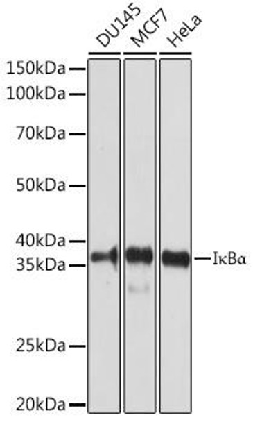 Immunology Antibodies 1 Anti-IkBAlpha Antibody CAB1187