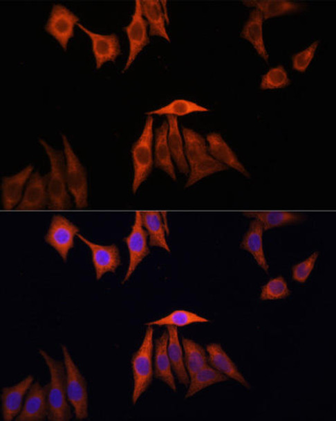 Cell Biology Antibodies 2 Anti-KRAS Antibody CAB1190