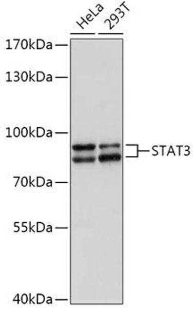 KO Validated Antibodies 1 Anti-STAT3 Antibody CAB1192KO Validated