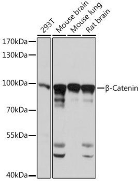 Cell Biology Antibodies 2 Anti-Beta-Catenin Antibody CAB11932