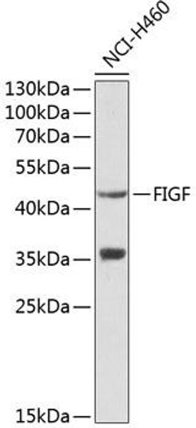 Cardiovascular Antibodies Anti-FIGF Antibody CAB1194