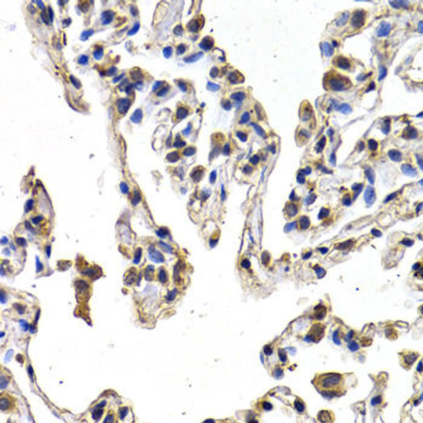 Cardiovascular Antibodies Anti-FIGF Antibody CAB1194