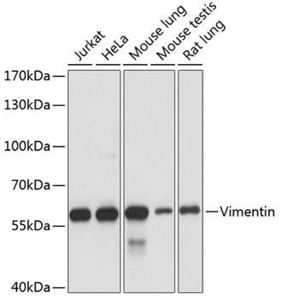 KO Validated Antibodies 1 Anti-Vimentin Antibody CAB11952KO Validated