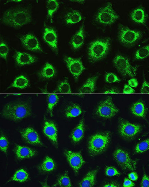 Autophagy Antibodies Anti-ATG16L1 Antibody CAB11969