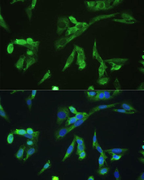 Immunology Antibodies 1 Anti-PD-1 Antibody CAB11973