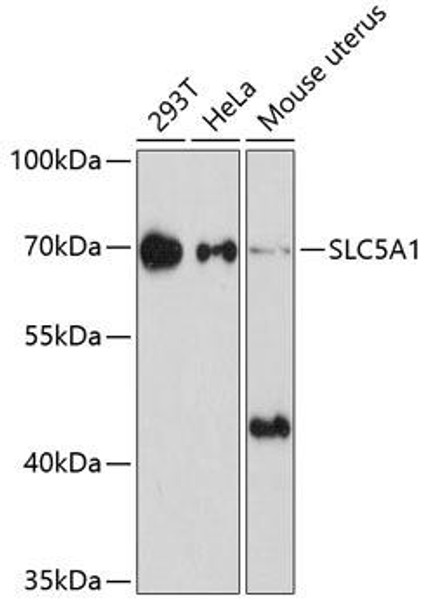 Signal Transduction Antibodies 1 Anti-SLC5A1 Antibody CAB11976