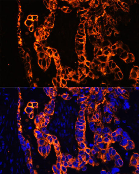 Immunology Antibodies 1 Anti-KRT7 Antibody CAB12004