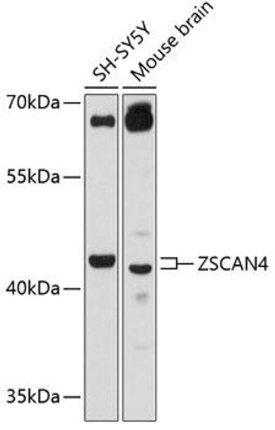 Epigenetics and Nuclear Signaling Antibodies 1 Anti-ZSCAN4 Antibody CAB12015