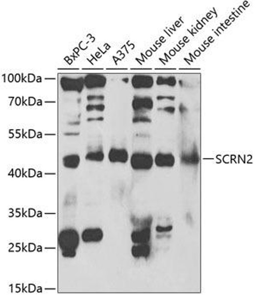 Cell Biology Antibodies 2 Anti-SCRN2 Antibody CAB1205