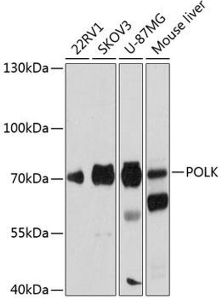 Epigenetics and Nuclear Signaling Antibodies 1 Anti-POLK Antibody CAB12052