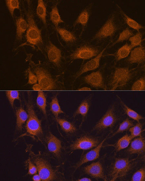 Signal Transduction Antibodies 1 Anti-SEL1L Antibody CAB12073