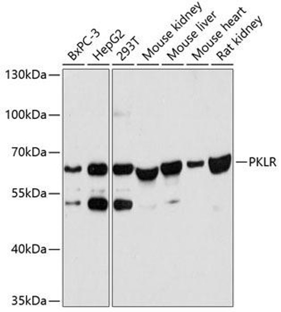 Metabolism Antibodies 1 Anti-PKLR Antibody CAB12084