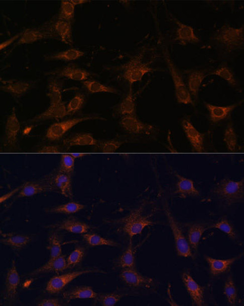 Cell Biology Antibodies 2 Anti-RAB21 Antibody CAB12095