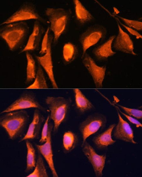 Cell Biology Antibodies 2 Anti-RAB21 Antibody CAB12095